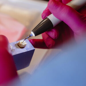 Au cœur de l’endo : Secrets & Stratégies