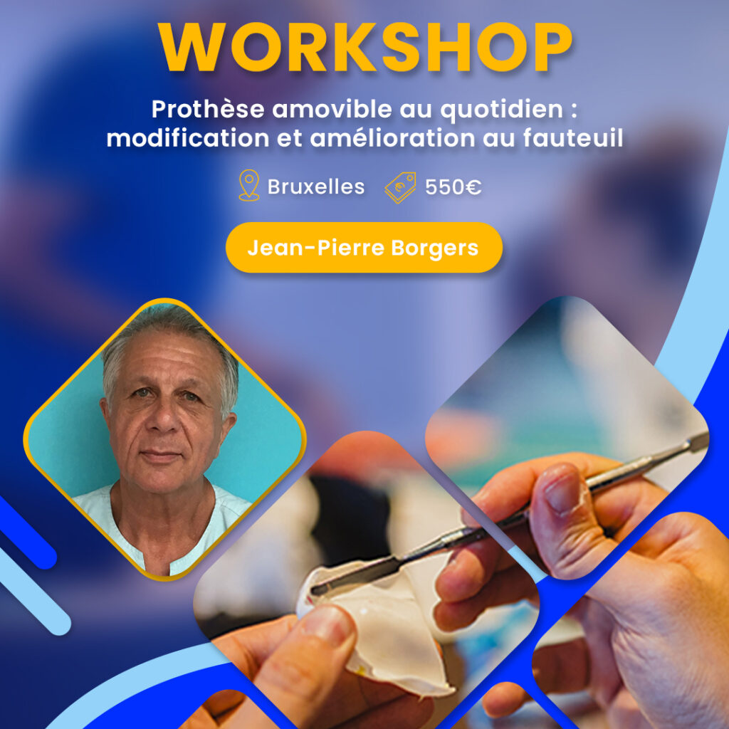 Workshop dentaire sur la prothèse amovible