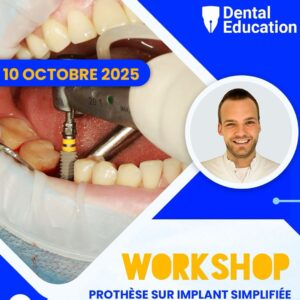 Prothèse sur implant Simplifiée