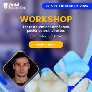 Les restaurations adhésives postérieures indirectes